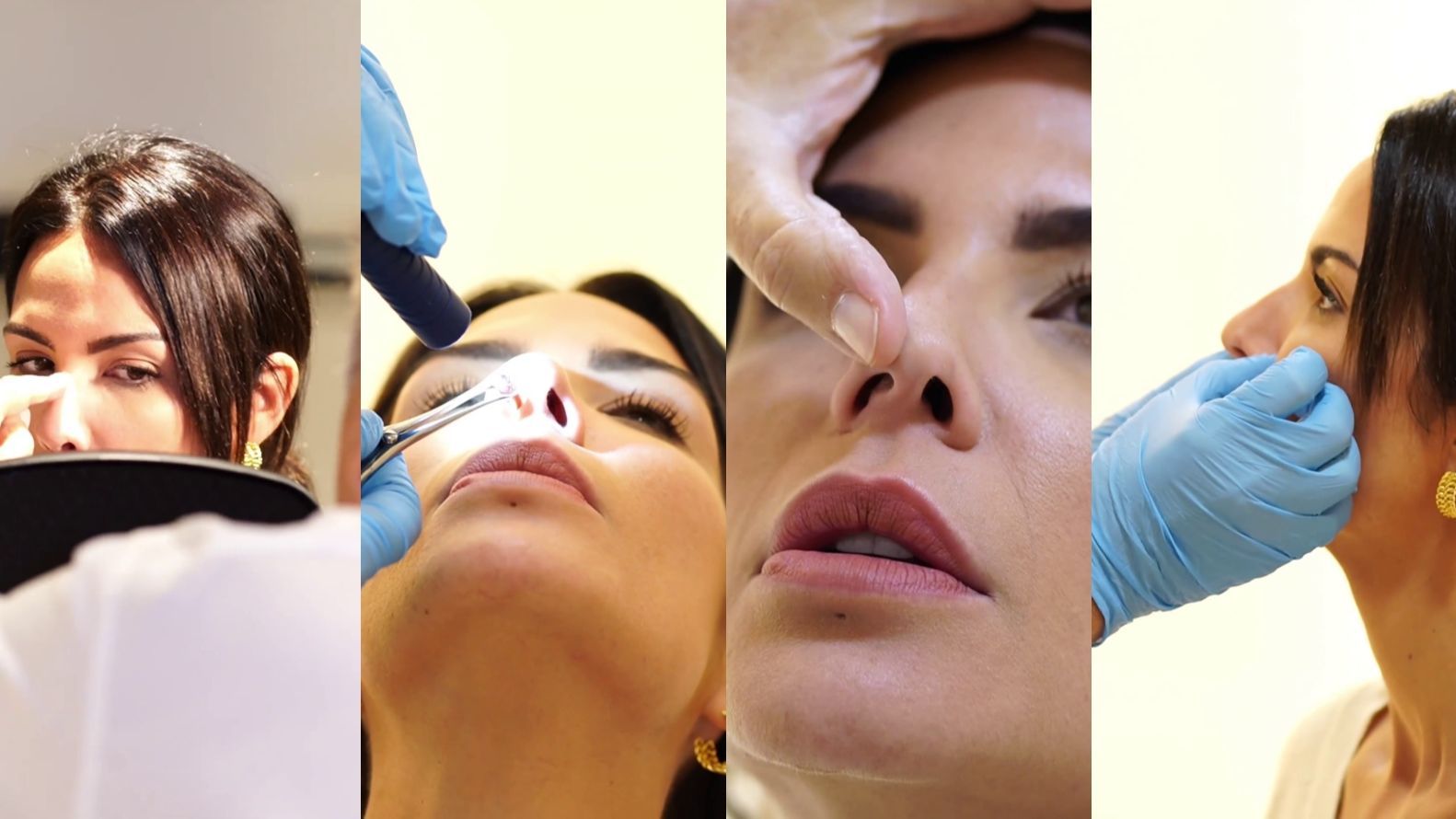 El cirujano de Tamara Gorro estudia su nariz