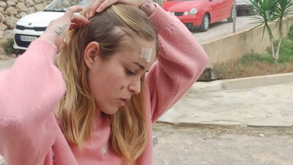 Una joven ha sufrido una brutal paliza de un desconocido por defender a un amiga