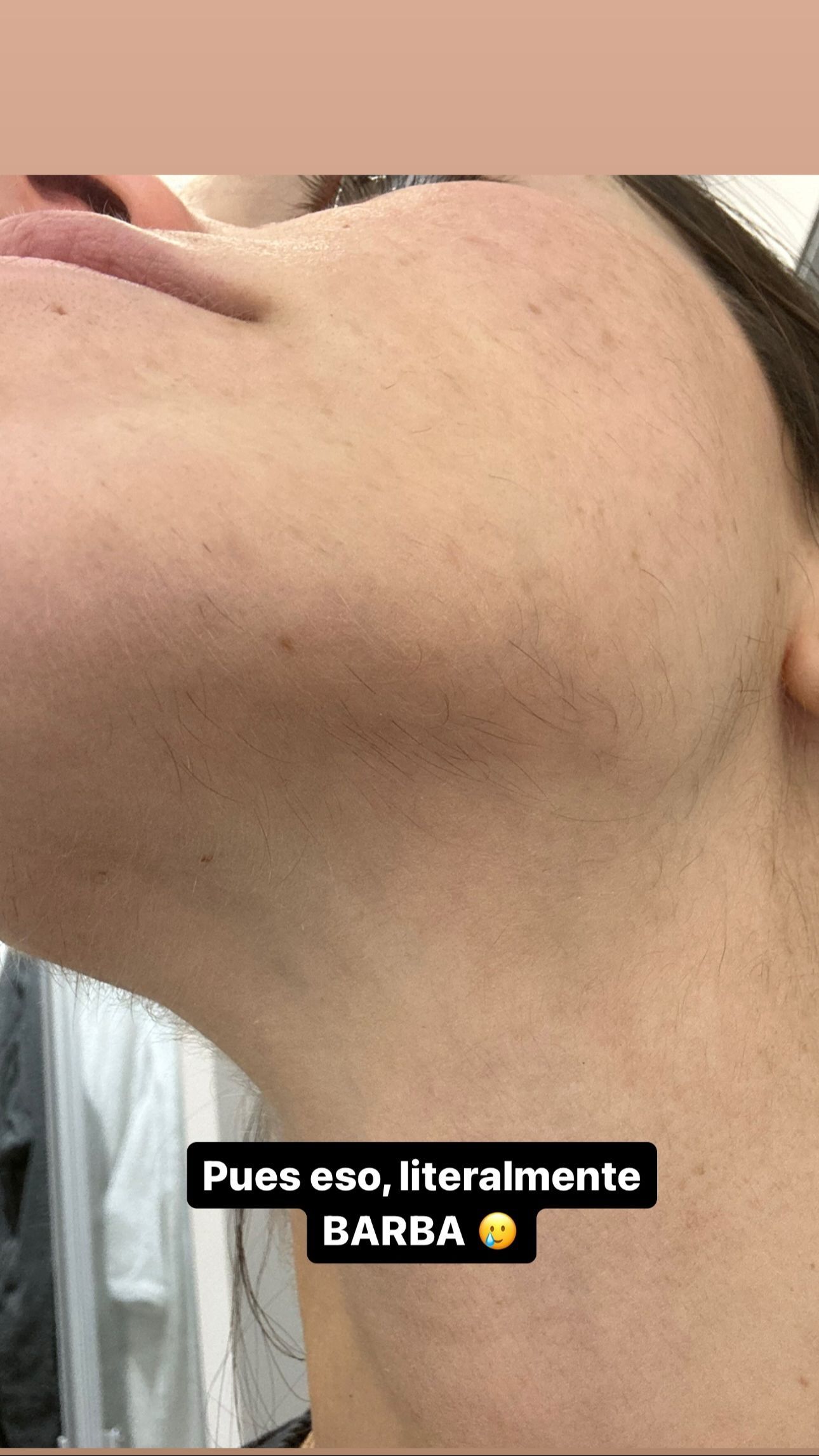 La imagen con la que Violeta Mangriñán ha visibilizado su problema de vello facial