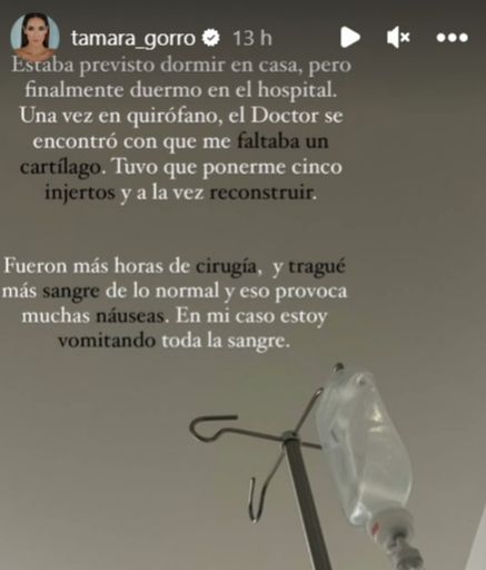 Tamara Gorro y su operación de nariz