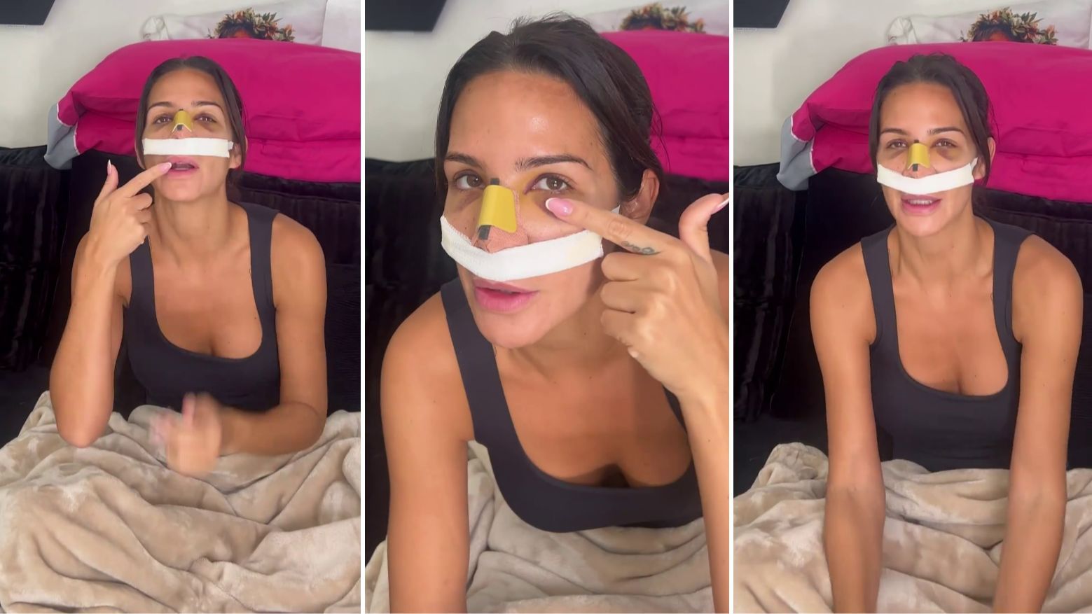 Tamara Gorro muestra cómo tiene la cara tras someterse a una rinoplastia