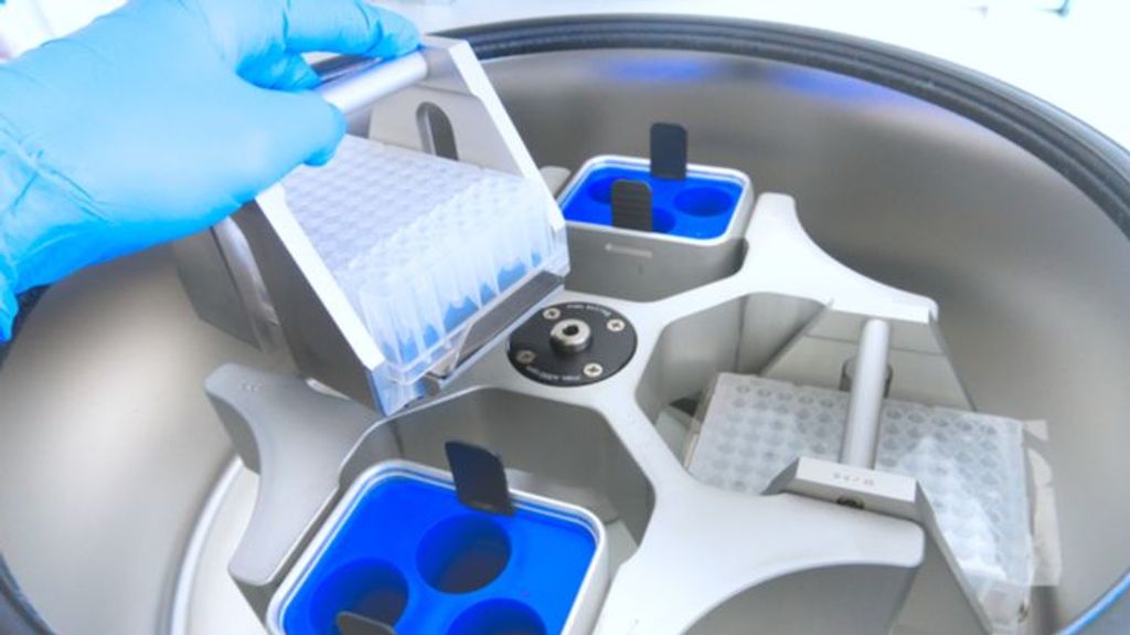 La biopsia líquida se convierte en la prueba que revolucionará la forma de detectar el cáncer