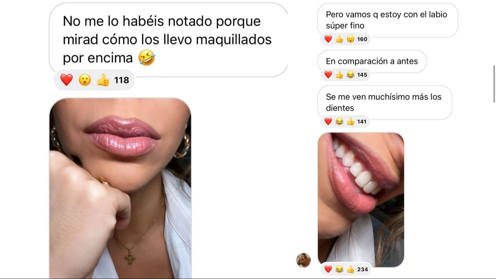 Cristina Porta se ha maquillado los labios para disimular la falta de ácido