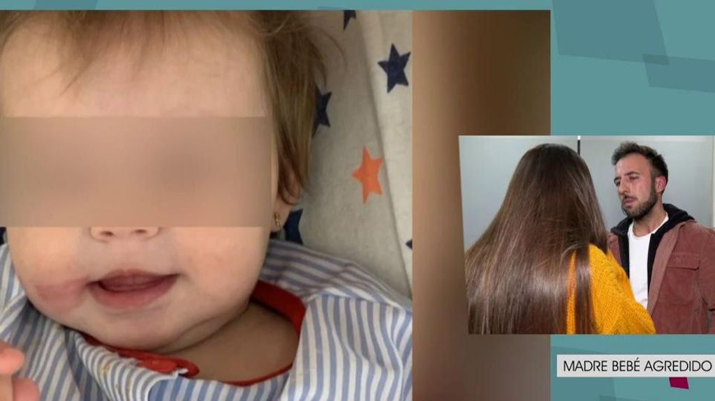 La madre de otro bebé agredido en la Escuela Infantil de Elche: "Mi bebé venía con bocados en la espalda y mordeduras"