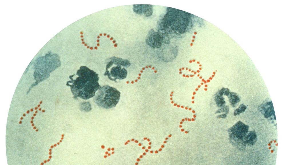 Bacteria vista a través del microscopio