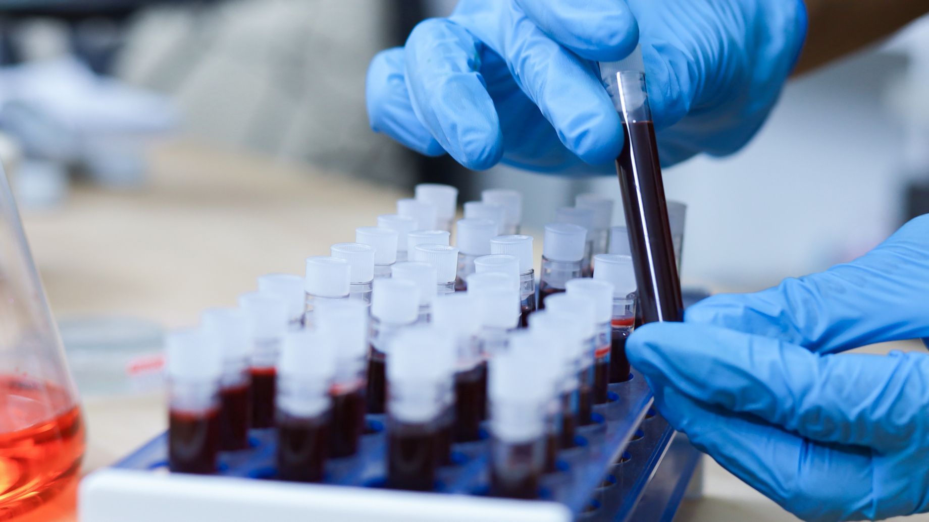 Ánalisis de sangre Ánalisis de sangre