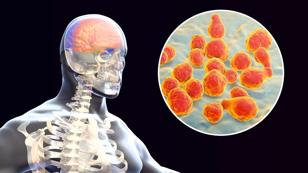 La meningitis criptocócica