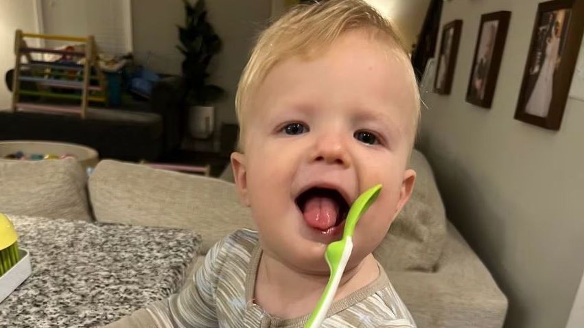 Owen a punto de cumplir 2 años se desarrolla como un niño normal tras recibir el trasplante parcial de tejido vivo