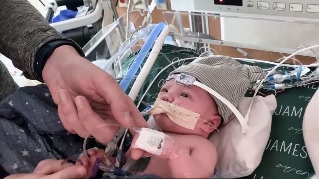 El primer trasplante de corazón con tejido vivo que salvó la vida del pequeño Owen