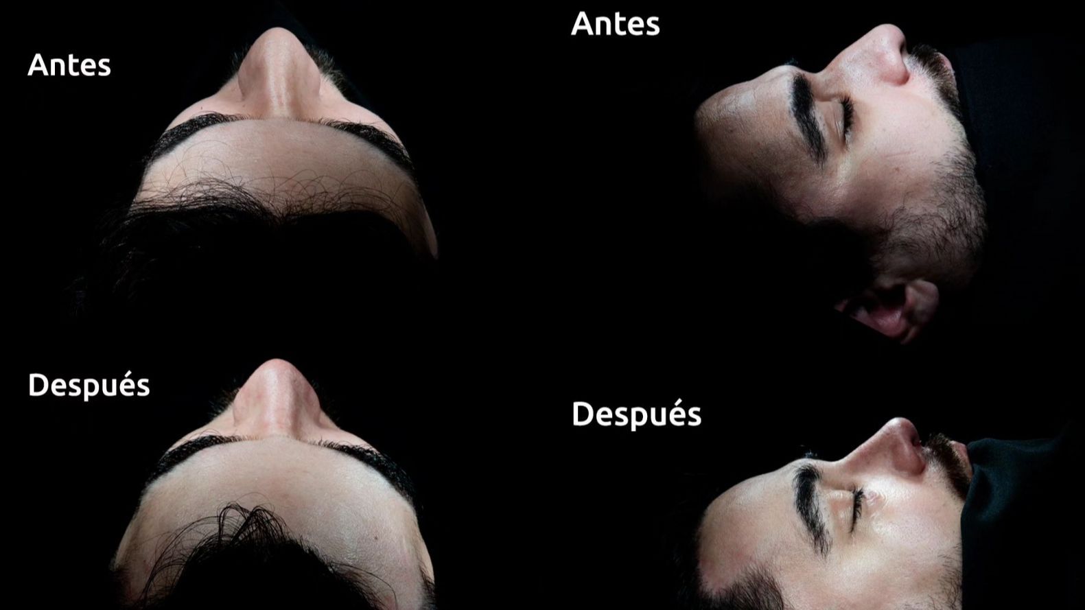 nariz rafa moya novio mahi masegosa