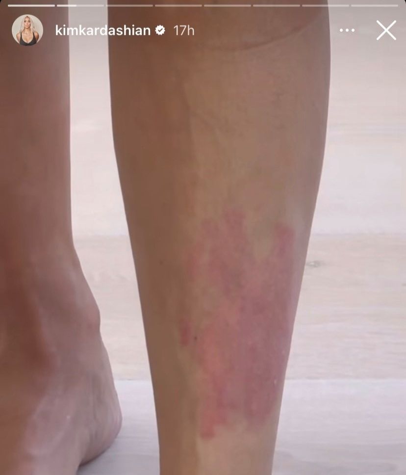Kim Kardashian comparte un vídeo enseñando su brote