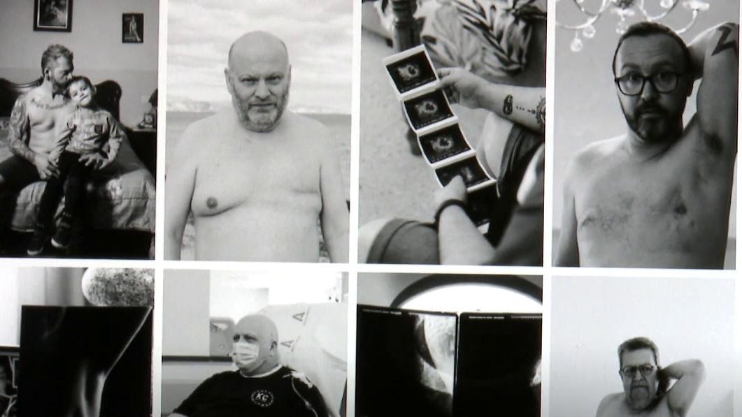 Cáncer de mama en hombres