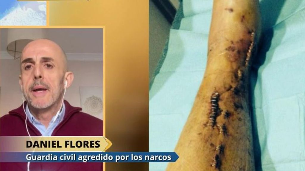 Daniel Flores, guardia civil agredido por los narcos: "Nos enfrentamos a la muerte a diario"