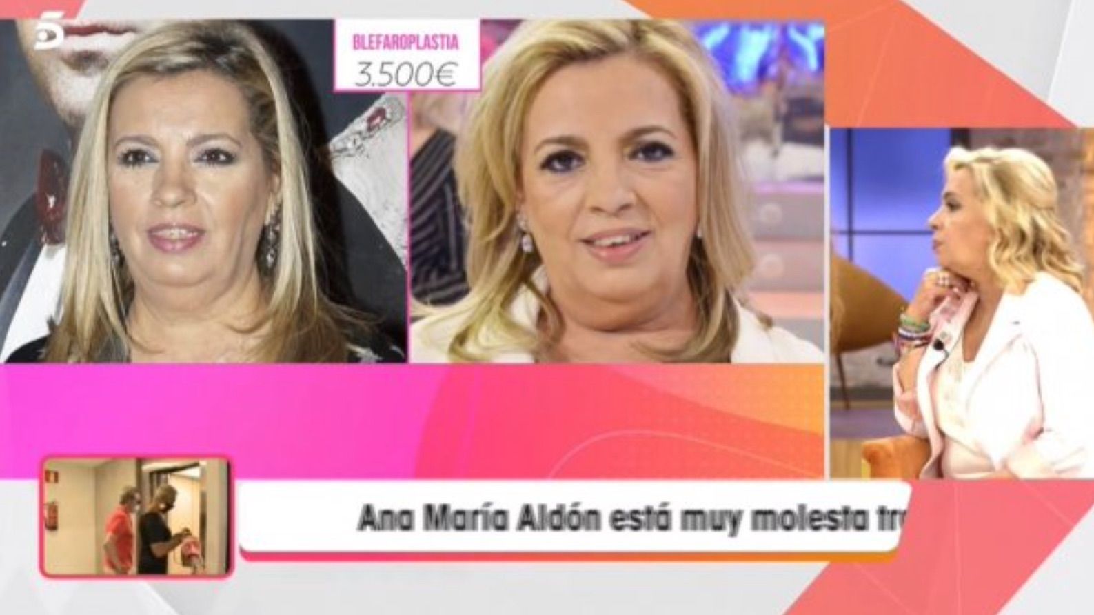 El antes y después de la blefaroplastia de Carmen Borrego en 'Fiesta'