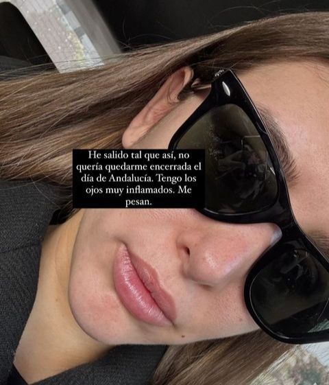 Marina García reconoce tener los ojos muy inflamados tras la cirugía