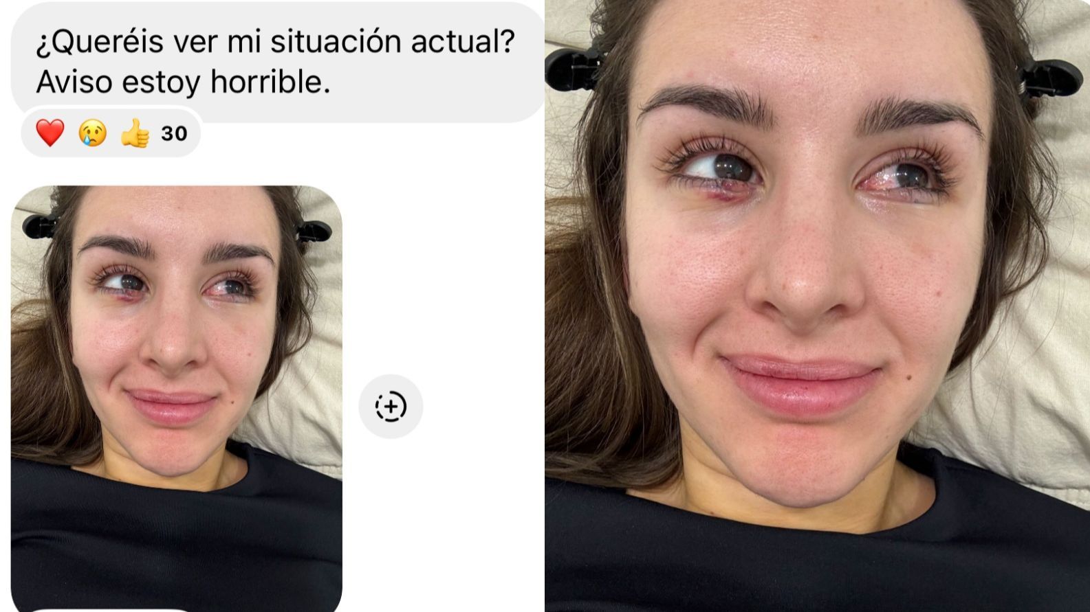 Marina García se opera de una "deformidad"