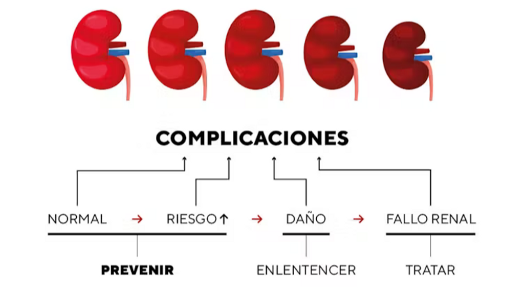 ¿Cómo sabemos que nuestros riñones están enfermos?