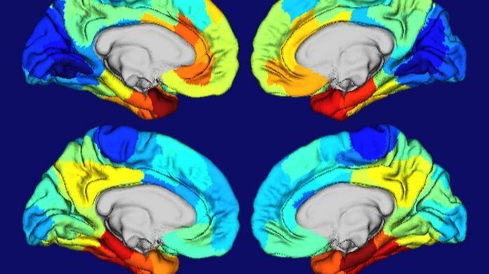 Zonas del cerebro dañadas por el alzhéimer Zonas del cerebro dañadas por el alzhéimer