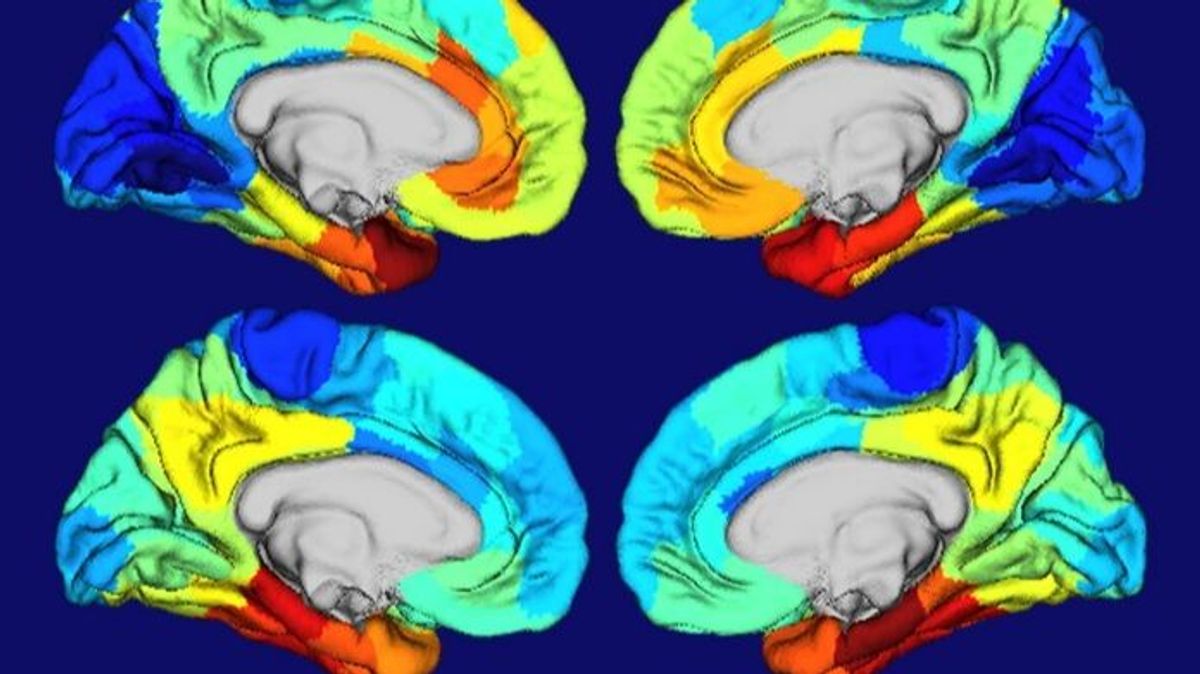 Zonas del cerebro dañadas por el alzhéimer
