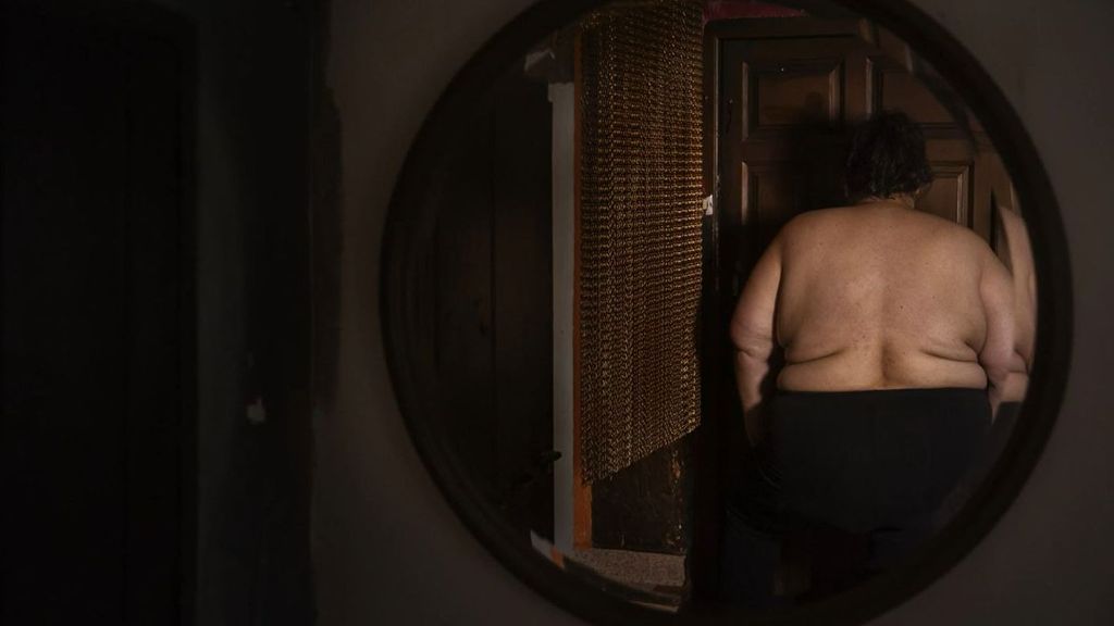 'Acompañando a Rosa', la exposición sobre la estigmatización de la obesidad mórbida: "Te refugias en la comida y a la vez es tu cárcel"