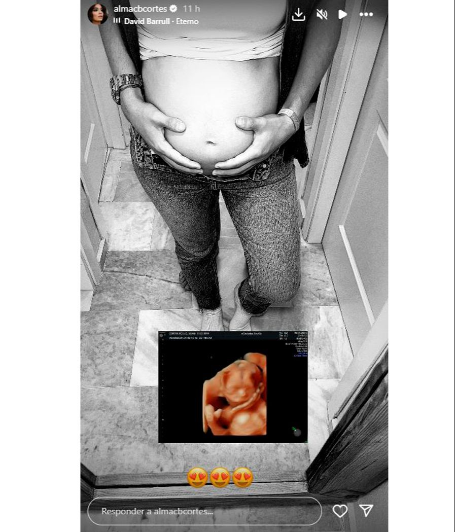 Alma Bollo enseña el rostro de Miguel, su segundo hijo