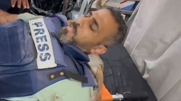 El camarógrafo Sami Shahada, en el hospital