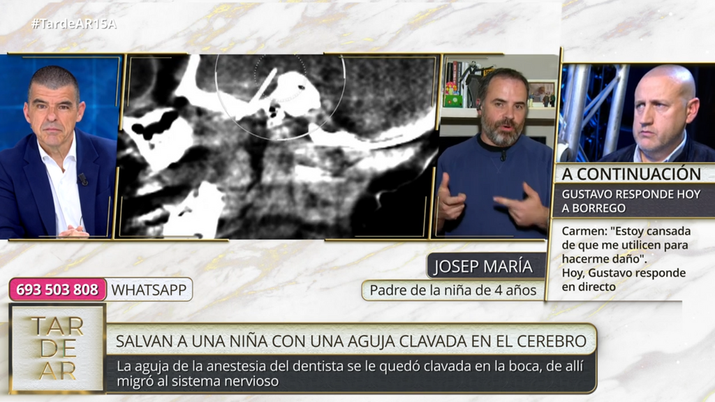 Josep María, el padre de la niña operada por una aguja clavada en el cerebro