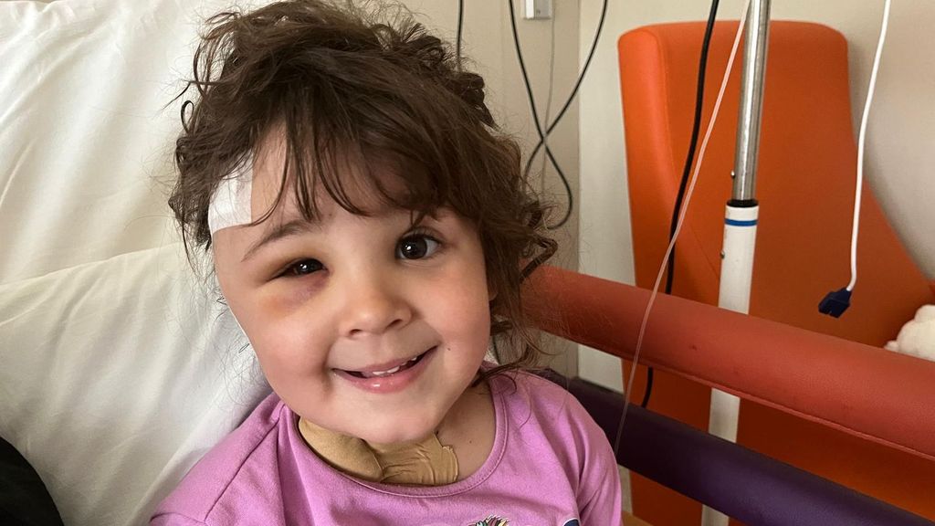 Operan con éxito a una niña que tenía una aguja del dentista clavada en el cerebro en Barcelona