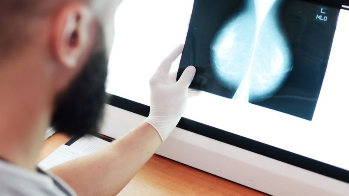 Las mamografías a partir de los 40 años son una herramienta importante para prevenir el cáncer de mama