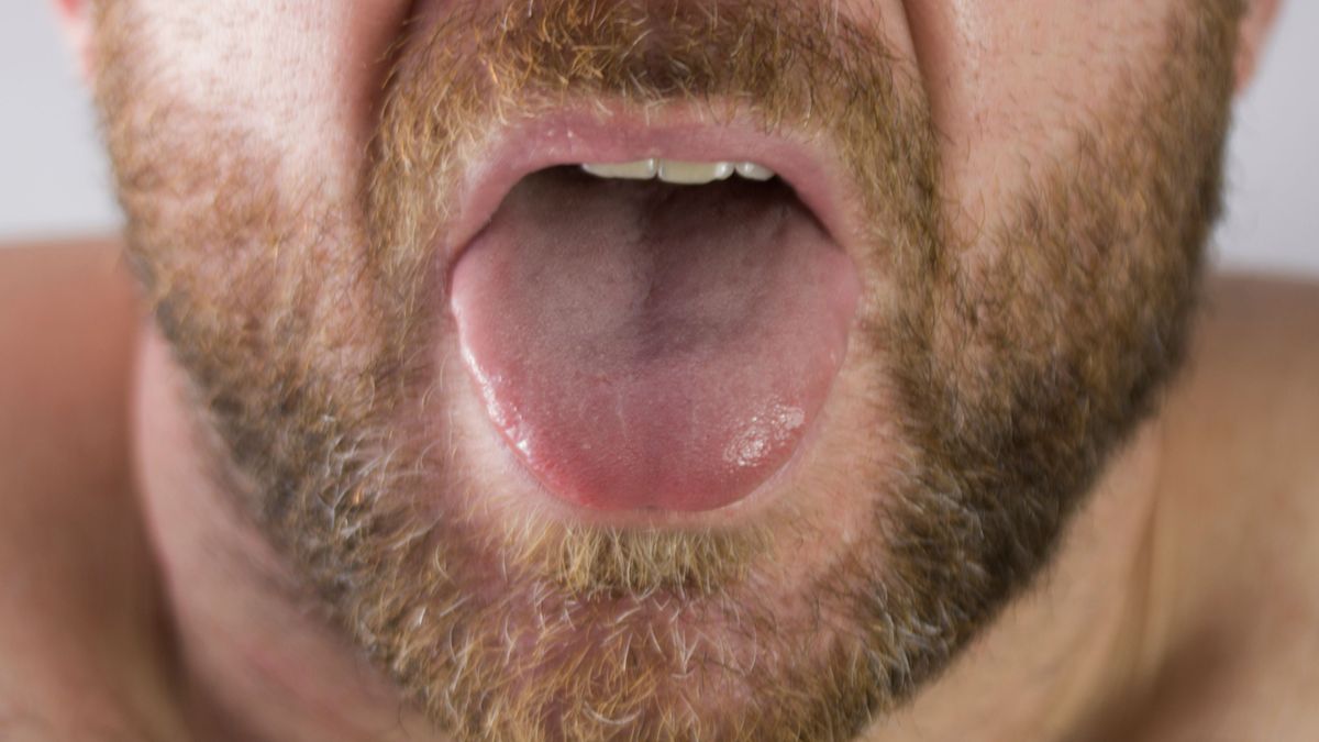 El color de la lengua dice mucho de nuestra salud