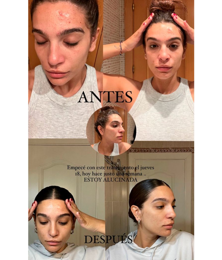 Alma Bollo enseña su increíble antes y después