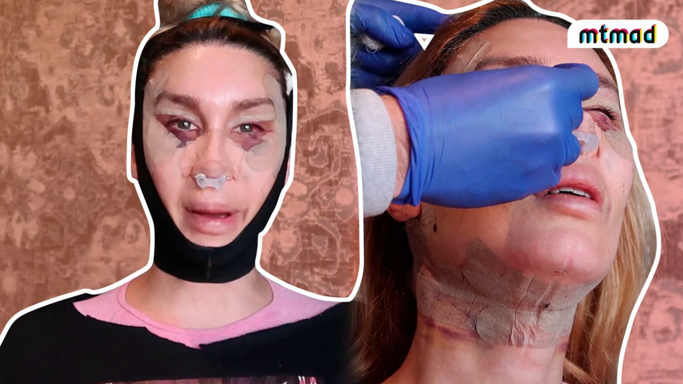 La Pelopony enseña su nuevo rostro tras someterse a seis operaciones estéticas Mi momento Temporada 1 Capítulo 63