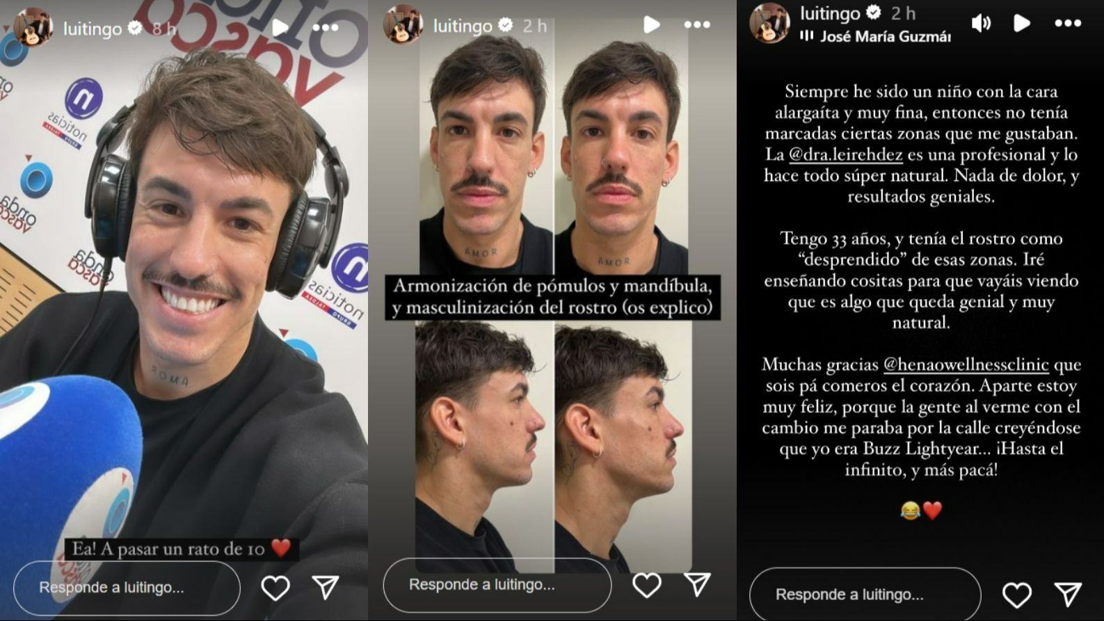 Luitingo muestra su cambio y explica por qué quería hacerse una masculinización facial