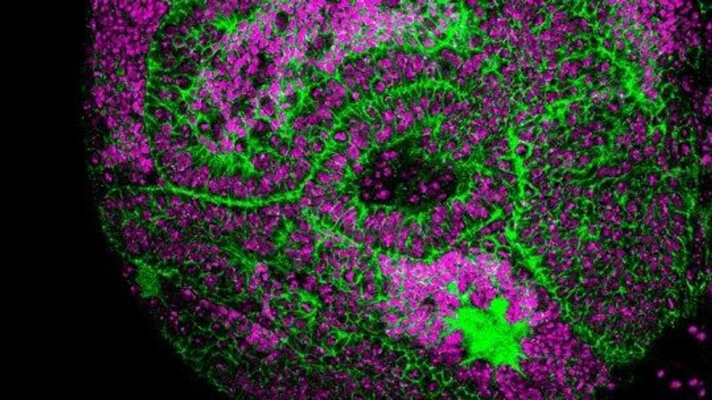 Unos investigadores descubren cómo reducir los tumores cerebrales en la mosca Drosophila
