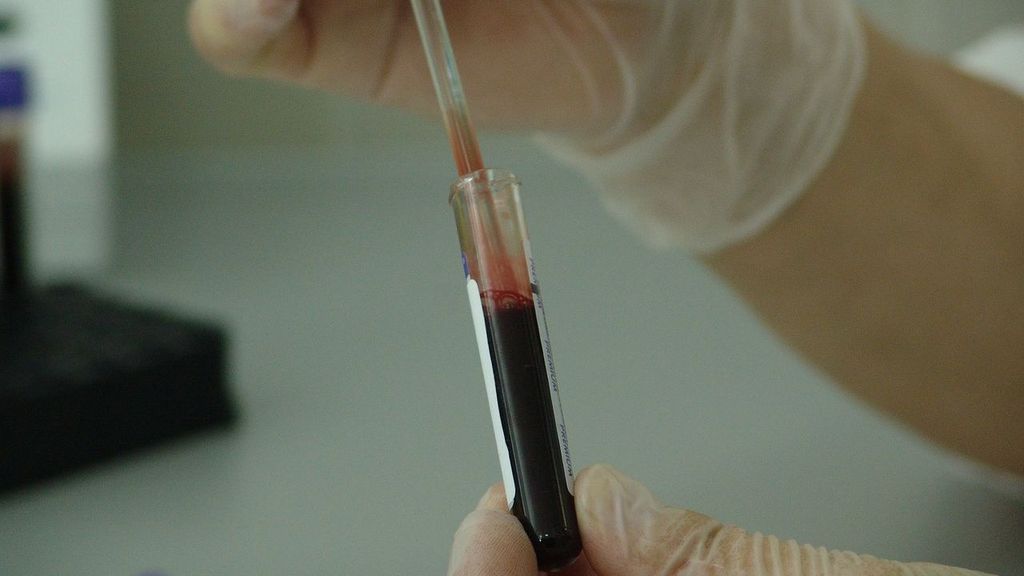 Reino Unido dará 245.749 euros por cada infectado vivo de sangre contaminada
