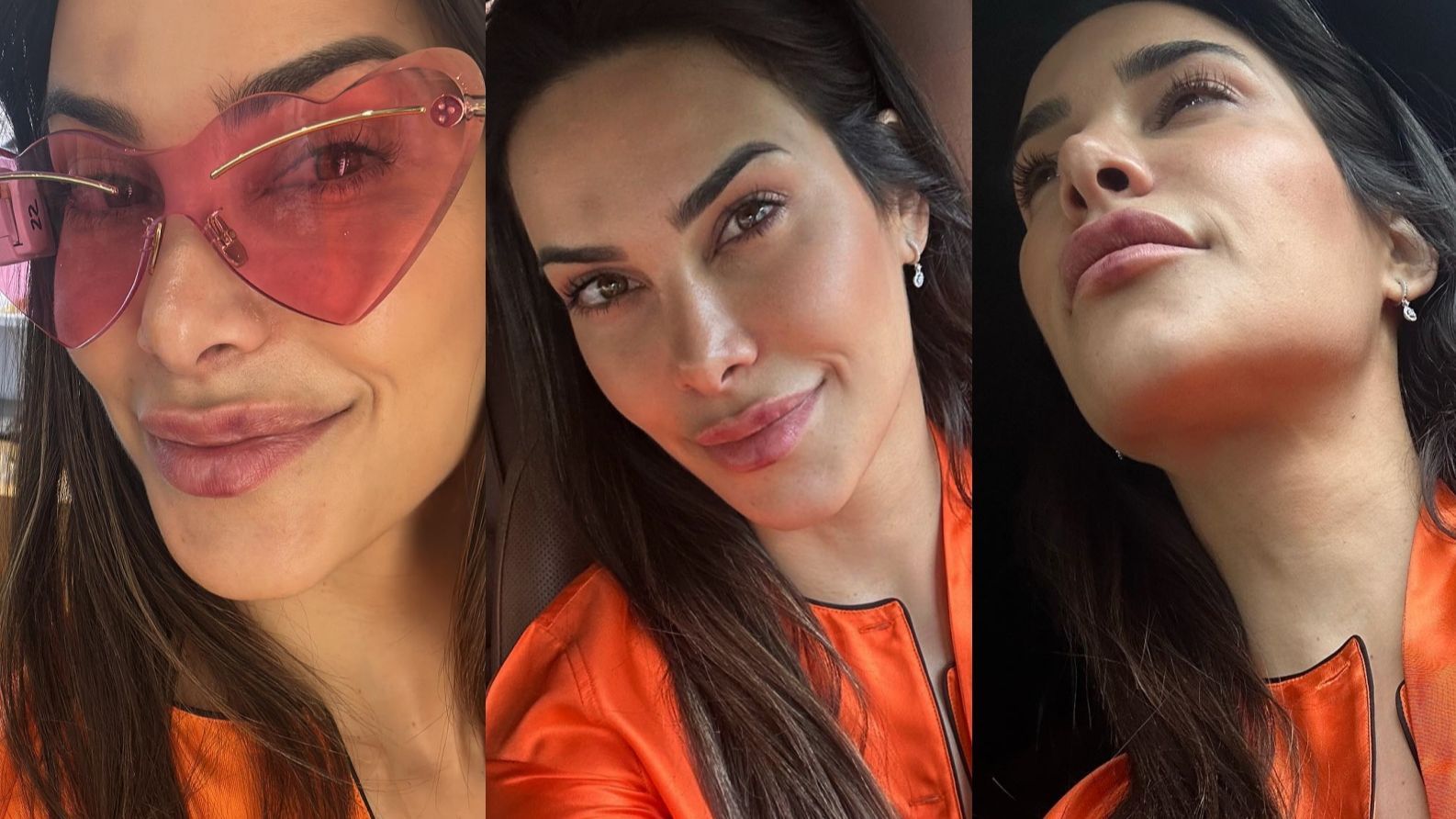 Carla Barber se realiza varios retoques estéticos en el rostro