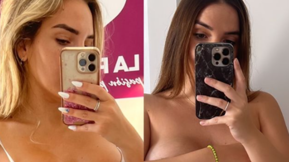 El antes y el después de Patri Pérez cuatro meses más tarde de su parto por cesárea