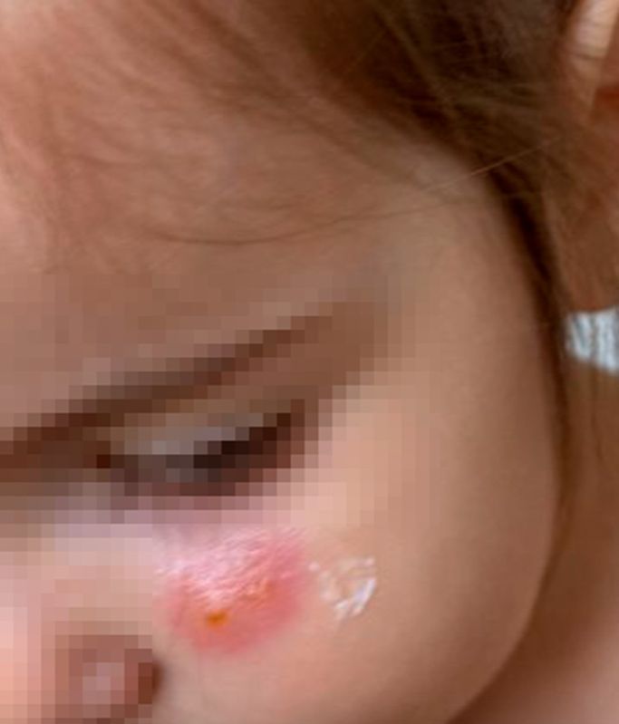 Violeta enseña cómo empeora el rostro de su hija