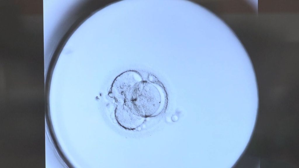 Los expertos aconsejan la congelación de óvulos en edad temprana