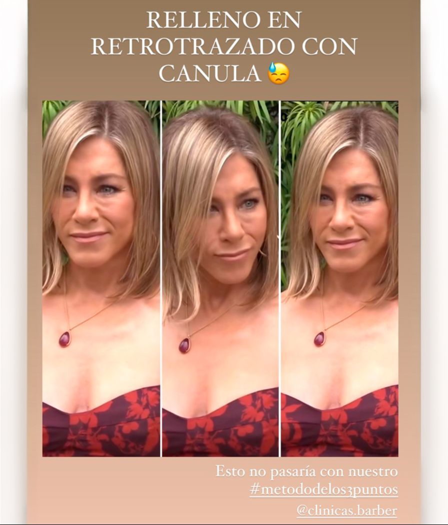 Carla Barber analiza el nuevo rostro de Jennifer Aniston