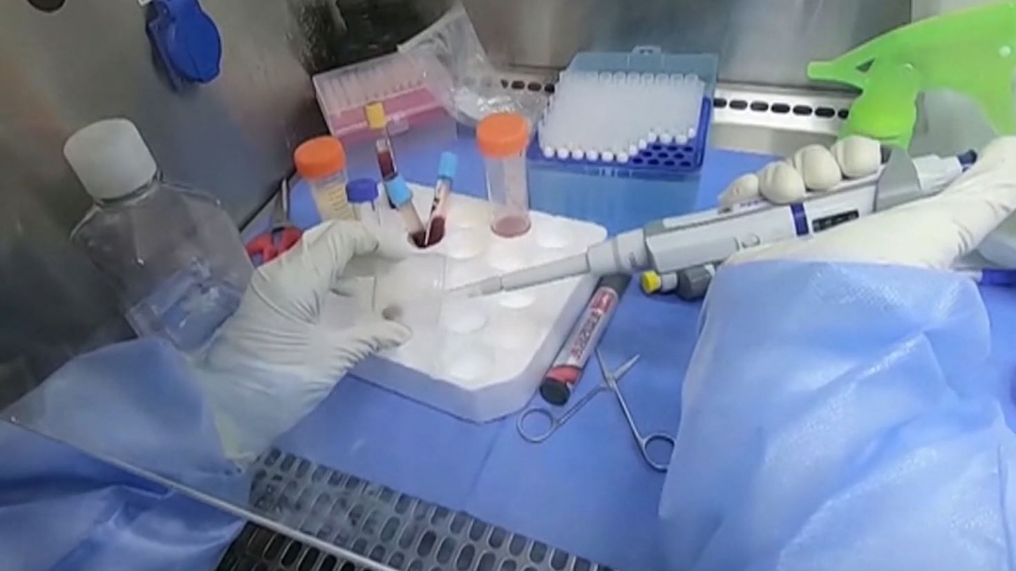 Cinco niños con sordera total consiguen escuchar por primera vez gracias a una terapia génica