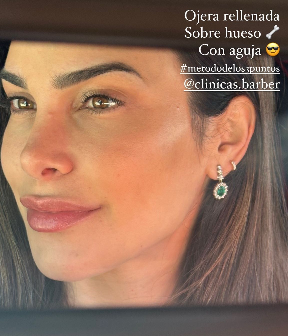 La exconcursante de 'Supervivientes' se pone a sí misma como buen ejemplo de retoque