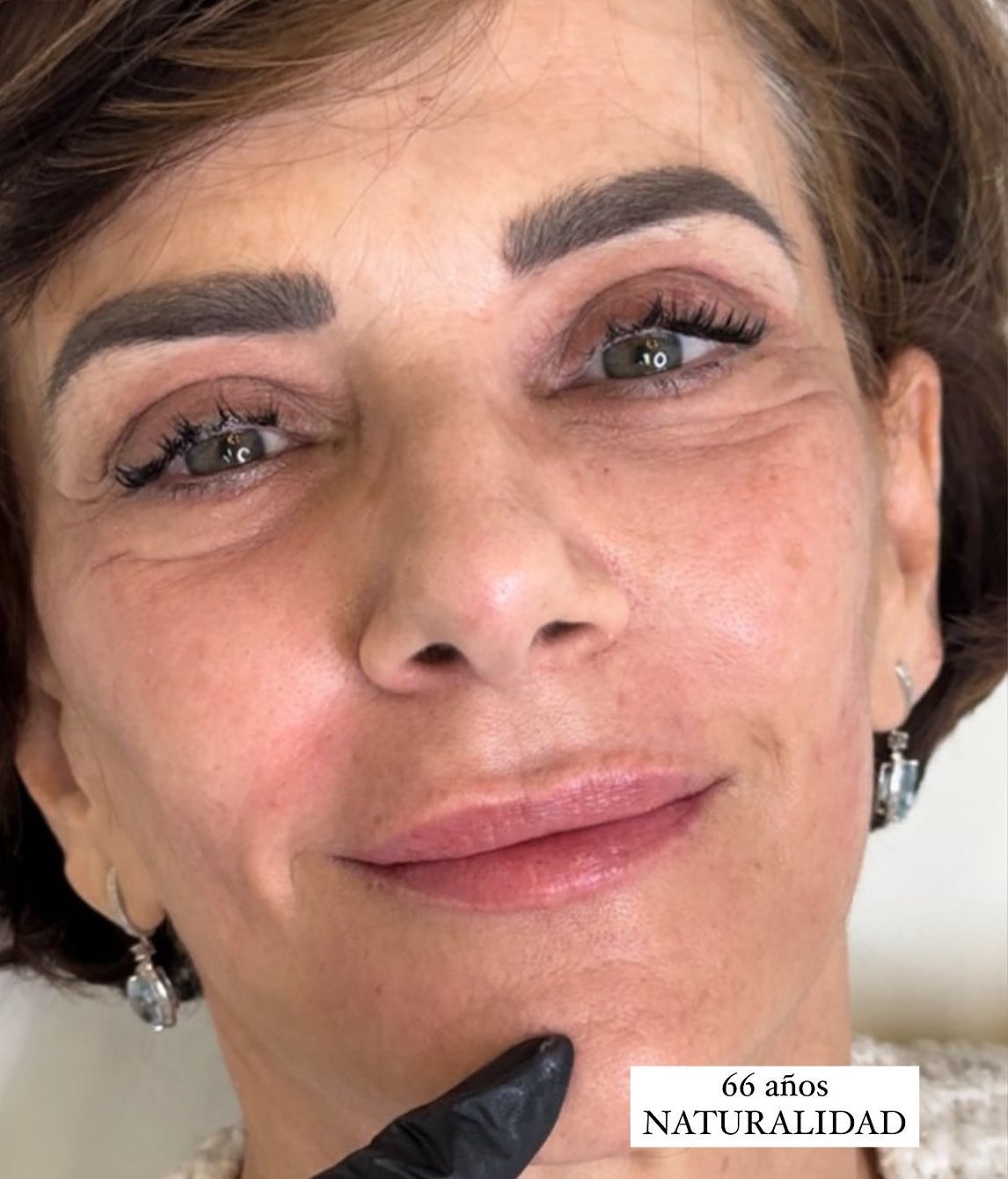 La influencer pone de ejemplo a su madre, de 66 años, como un buen ejemplo de retoque