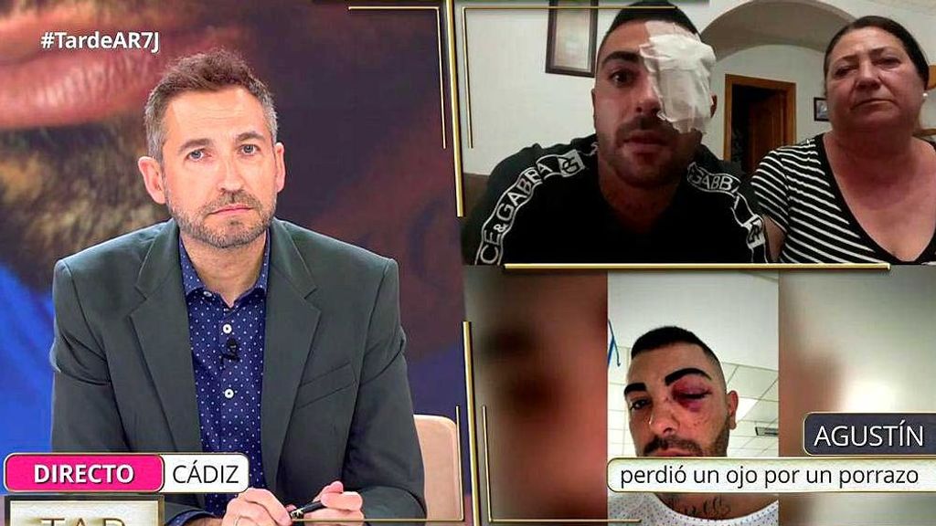 Un joven pierde en un ojo tras sufrir un porrazo de un guardia civil en medio de una pelea