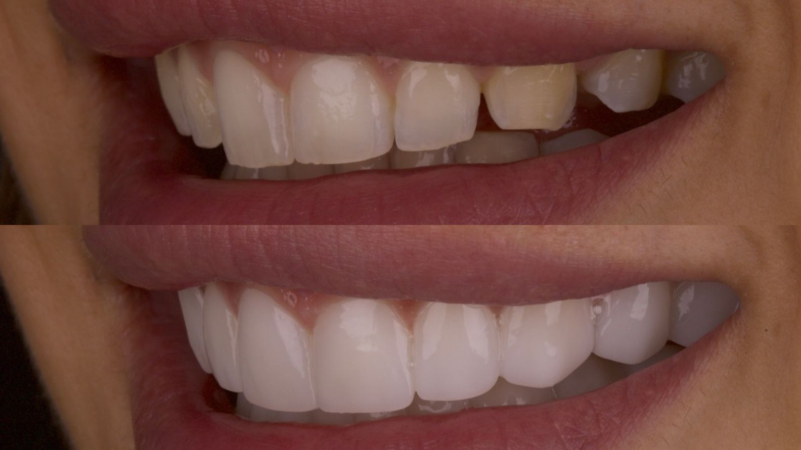 Así era y así es la nueva sonrisa de Estela Grande