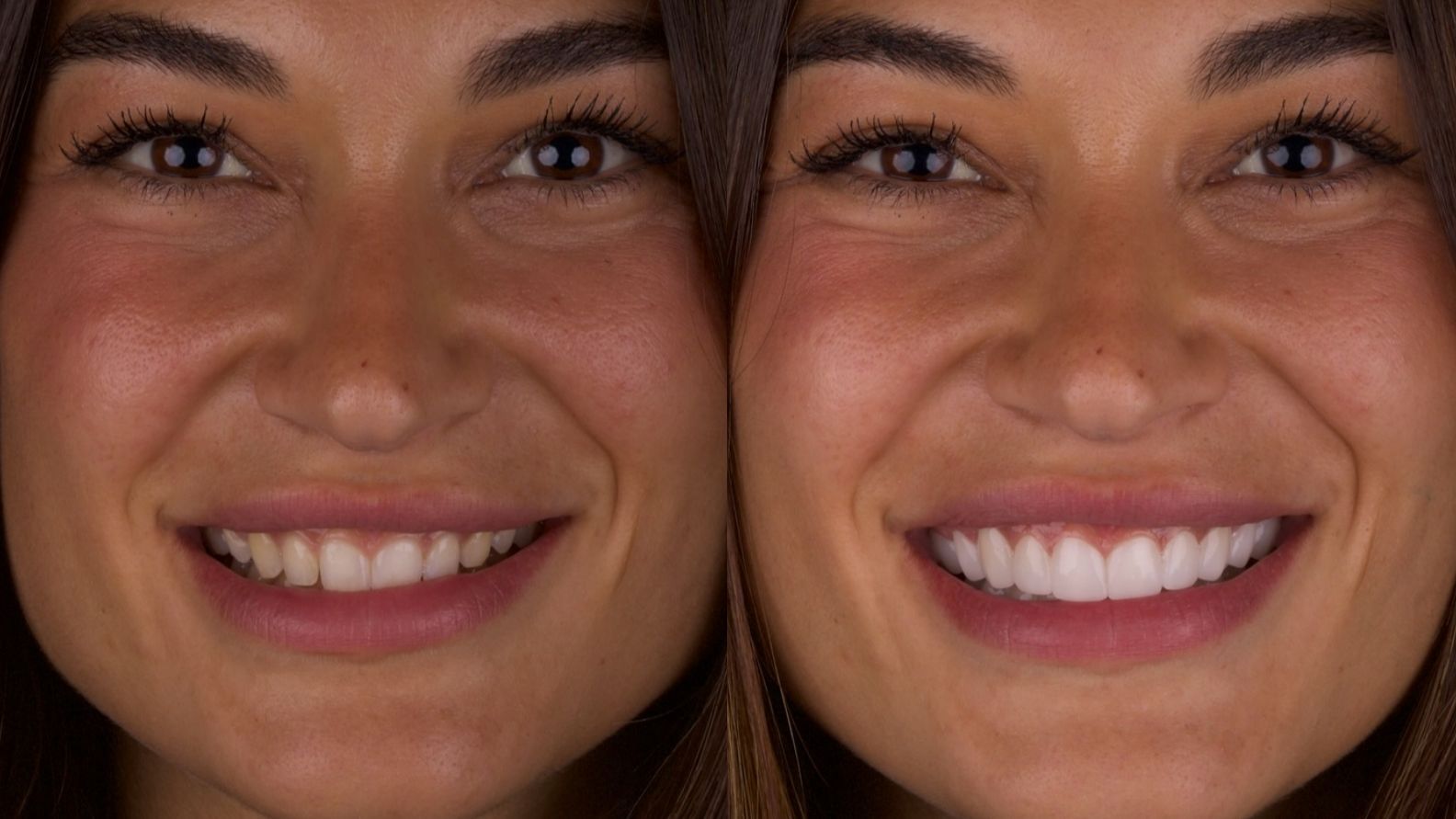 El antes y después de Estela Grande