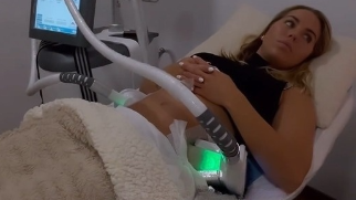 El antes y el después de la liposucción de Yoli, de 'Gran Hermano'