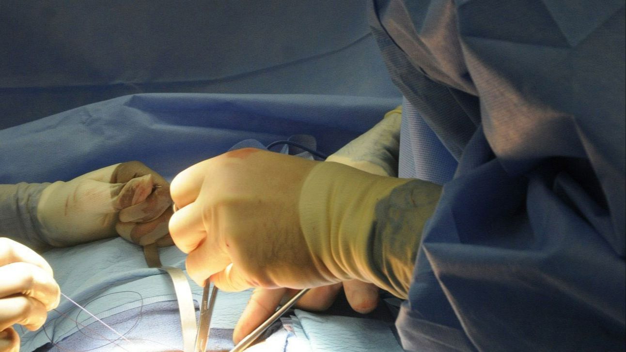 Condenan a un cirujano que cosió dos veces el intestino de un paciente de Valladolid que acabó muriendo Condenan a un cirujano que cosió dos veces el intestino de un paciente de Valladolid que acabó muriendo