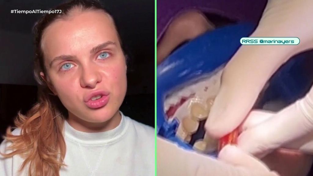 Hablamos con la influencer que lloró de dolor por un blanqueamiento dental en Tailandia: “Lo barato sale caro”