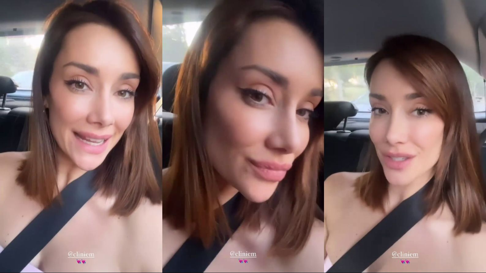 Adara Molinero enseña el resultado de su tratamiento